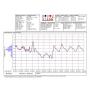 Registrador de datos de temperatura y humedad